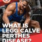 what is legg calve perthes disease